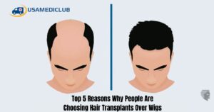 Read more about the article Top 5 Reasons Why People Are Choosing Hair Transplants Over Wigs